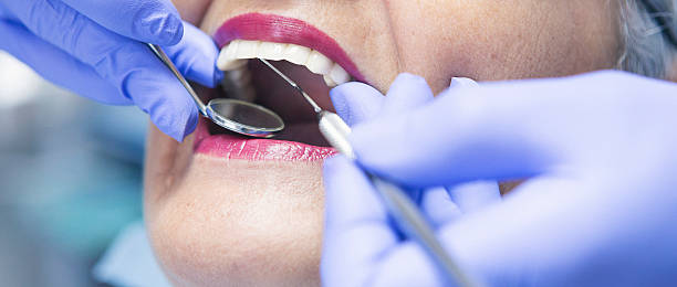 Best Urgent Care for Lost Fillings or Crowns in Whitefish Bay, WI